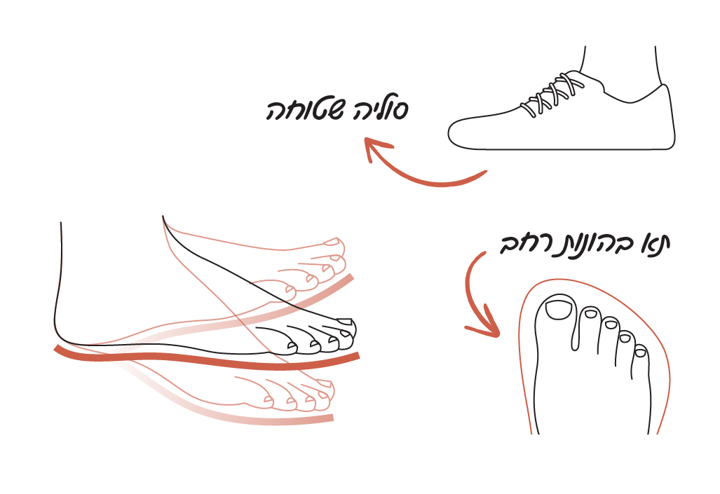 מפרידי בהונות ואופן השימוש בהם