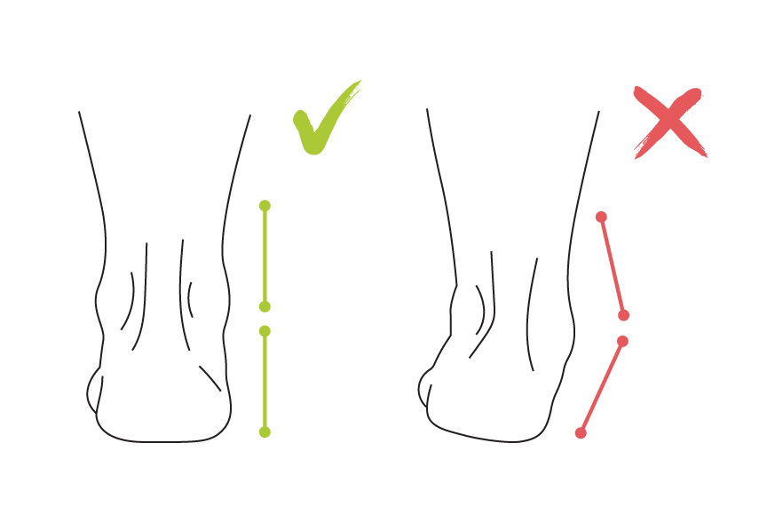 מפרידי בהונות ואופן השימוש בהם