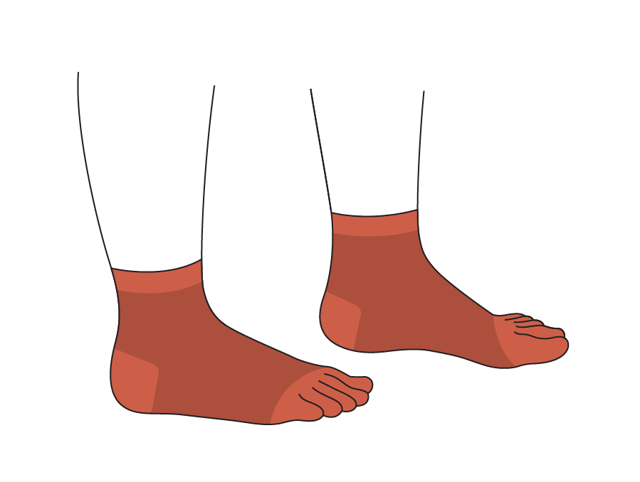 מפרידי בהונות ואופן השימוש בהם