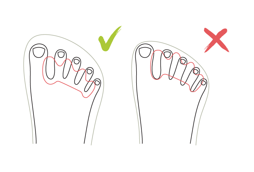 מפרידי בהונות ואופן השימוש בהם